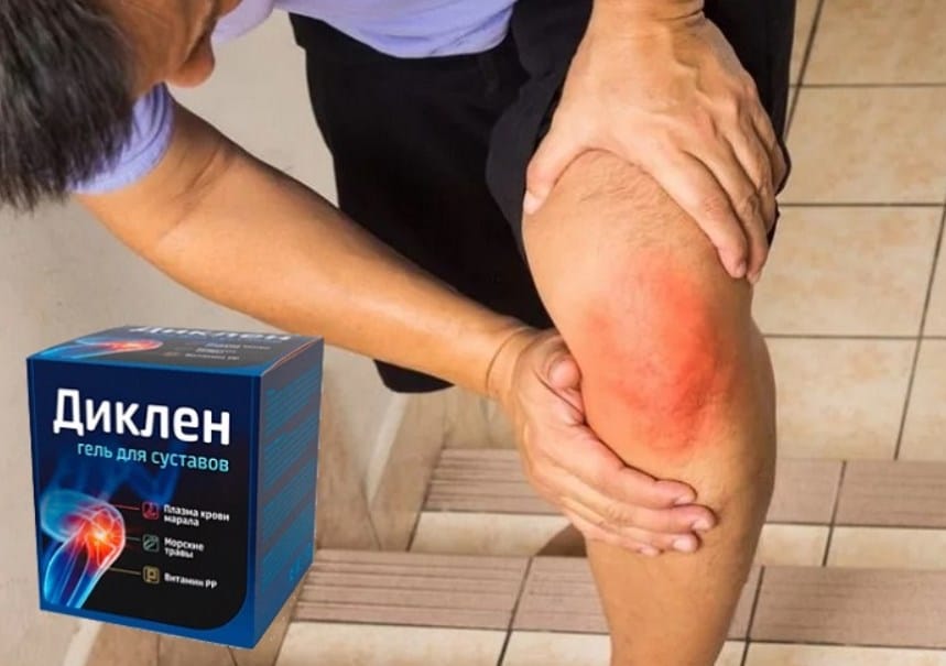 Диклен – эффективный гель для лечения суставов