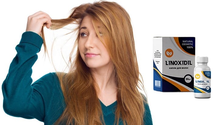 Linoxidil для роста волос: чтобы локоны всегда радовали вас своим внешним видом!