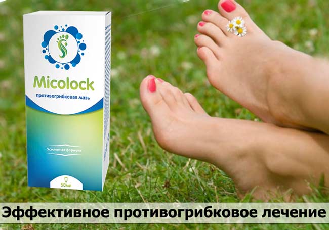 Миколок купить