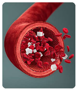 Высокий сахар в крови до применения средства Nordlys.