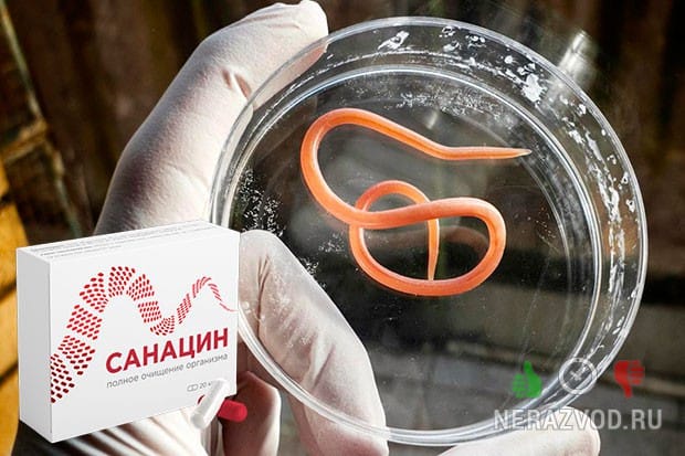 Санацин от паразитов