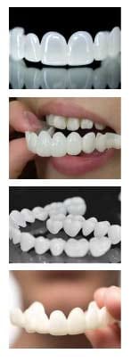 TruSmile состав