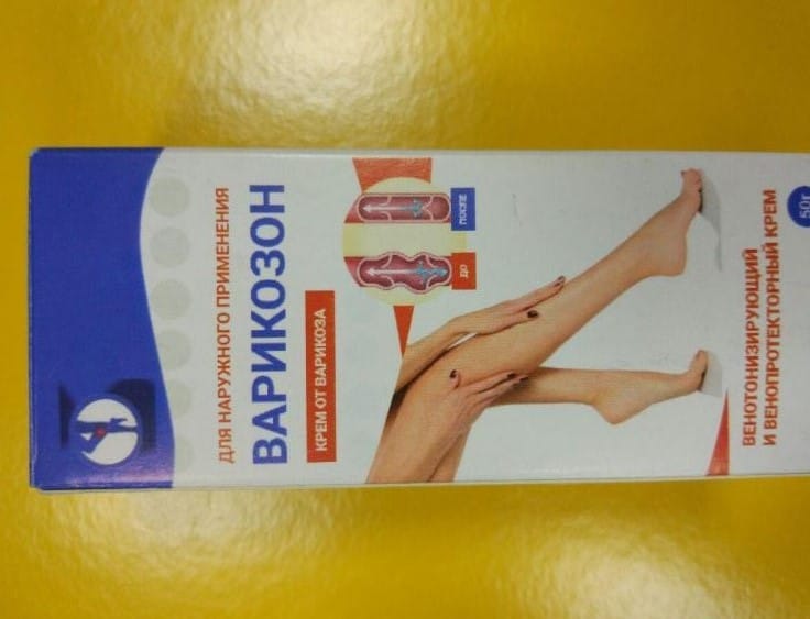 Варикозон для вен