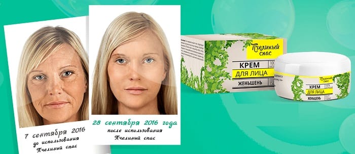 Пчелиный спас для омоложения: сотрите со своего лица 20 лет!